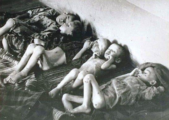 emaciated and sick children suffering at Jasenovac